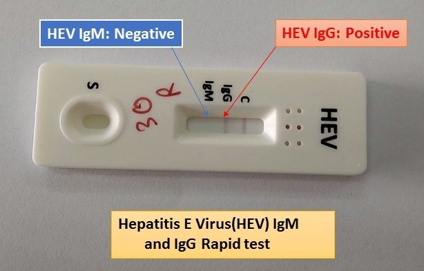 Hepatitis E Virus HEV Prevalence Transmission And Prevention   Hepatitis E Virus Rapid Test 