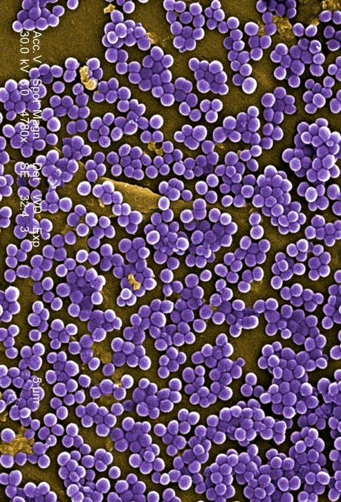 Staphylococcus aureus gram positive bacteria