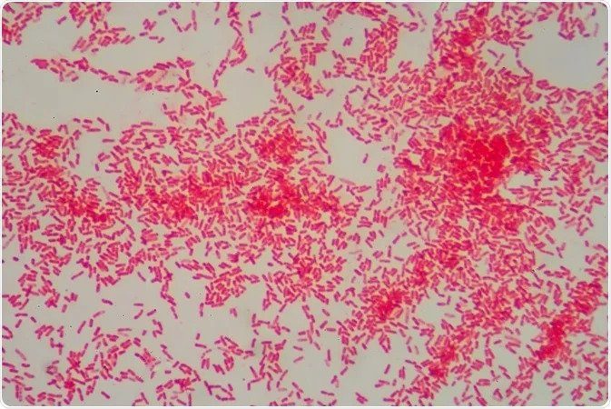 gram negative bacteria staining