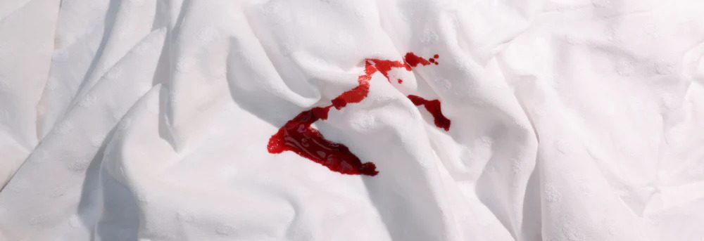 how to remove blood stains from sheets