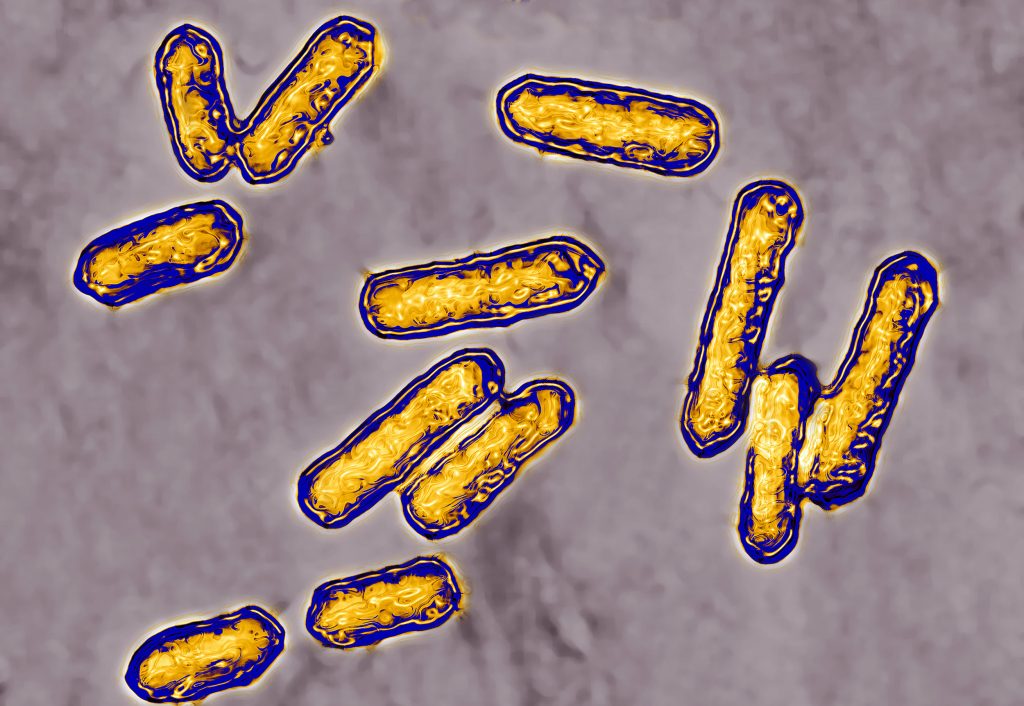 what is listeria
